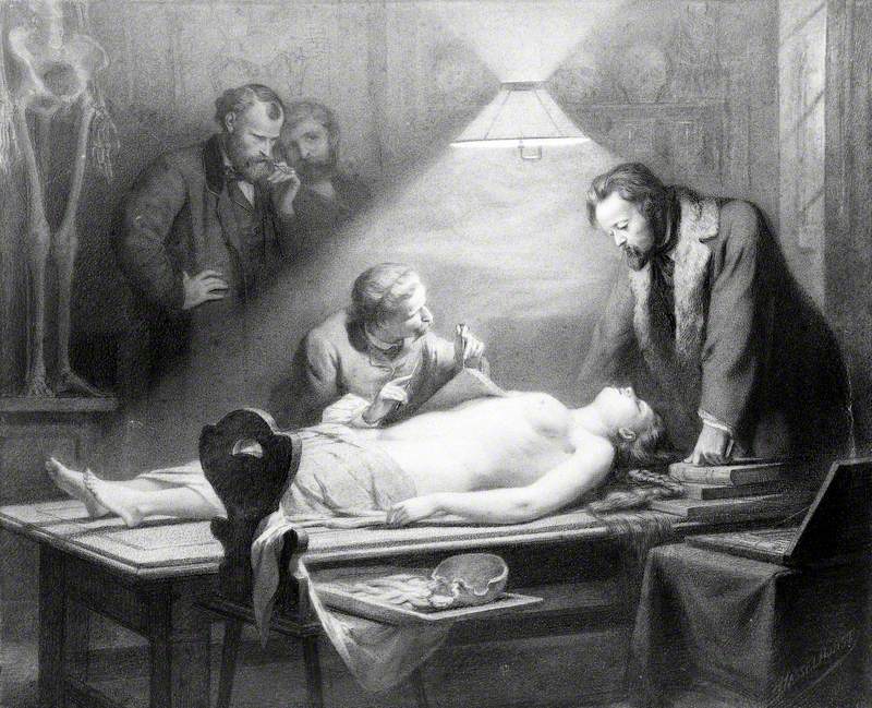 The Dissection of a Young, Beautiful Woman Directed by J. Ch. G. Lucae (1814–1885) in Order to Determine the Ideal Female Proportions
